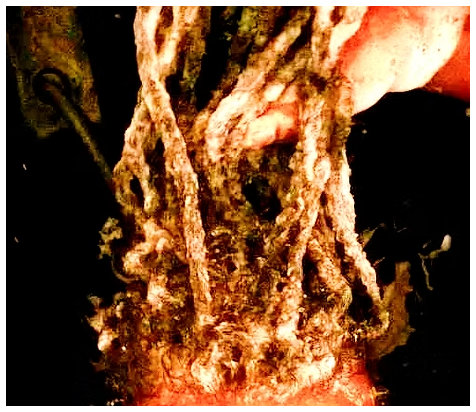 Loc Detox --$70-90)1-2hours